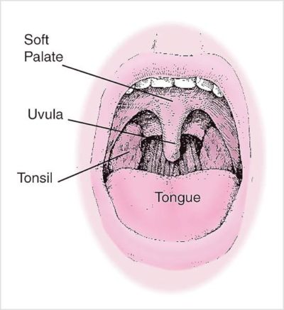 Medical Snoring Solution in Los Angeles - Stop Chronic Snoring