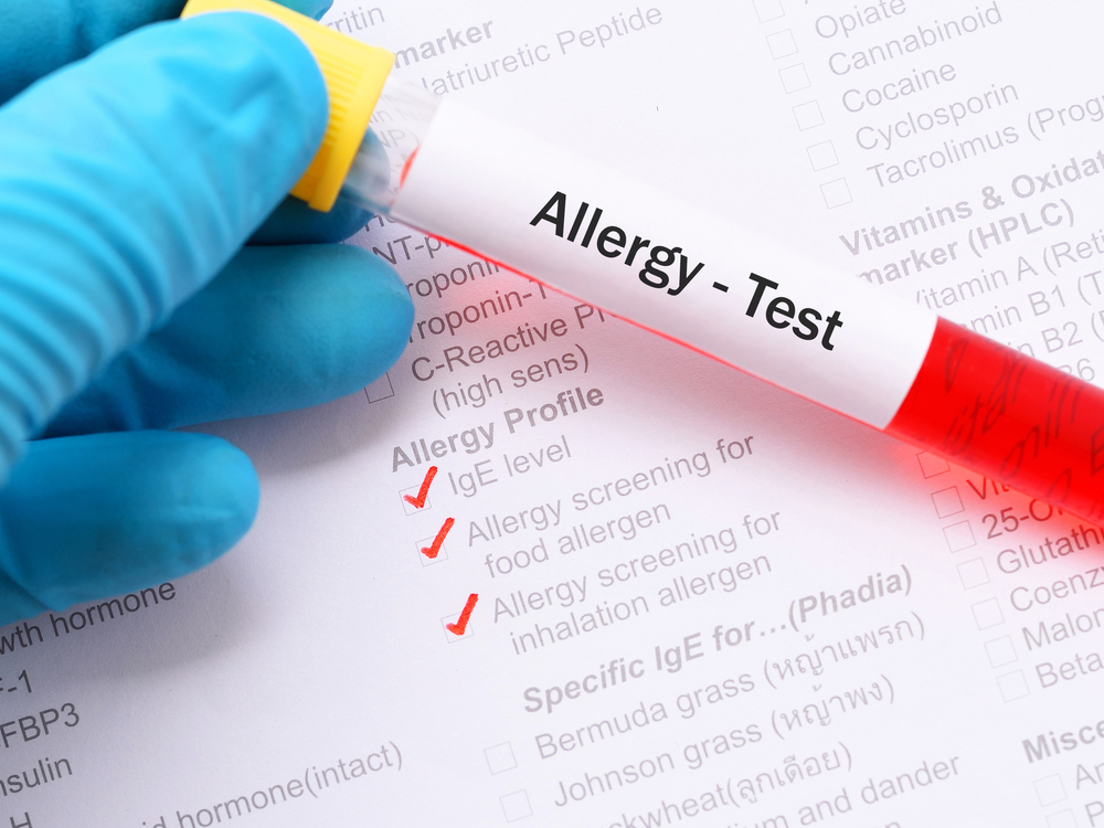 What Foods Are Tested in Blood Allergy Testing?